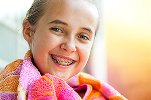 Which Braces Type Is Right for You?